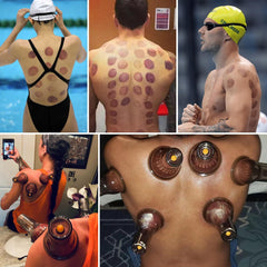 Cupping Set Cupping Therapy Set Massage Cups for Pain Relief Physical Therapy...